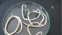 Ascaris lumbricoides alias cacing gelang (Foto: mjdrdypu.org)