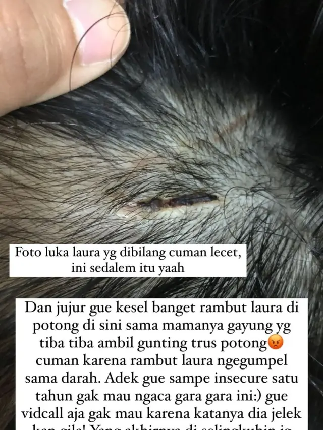 Unggahan Greta Iren soal luka di kepala Laura Anna. (Foto: Dok. Instagram @gretairn)