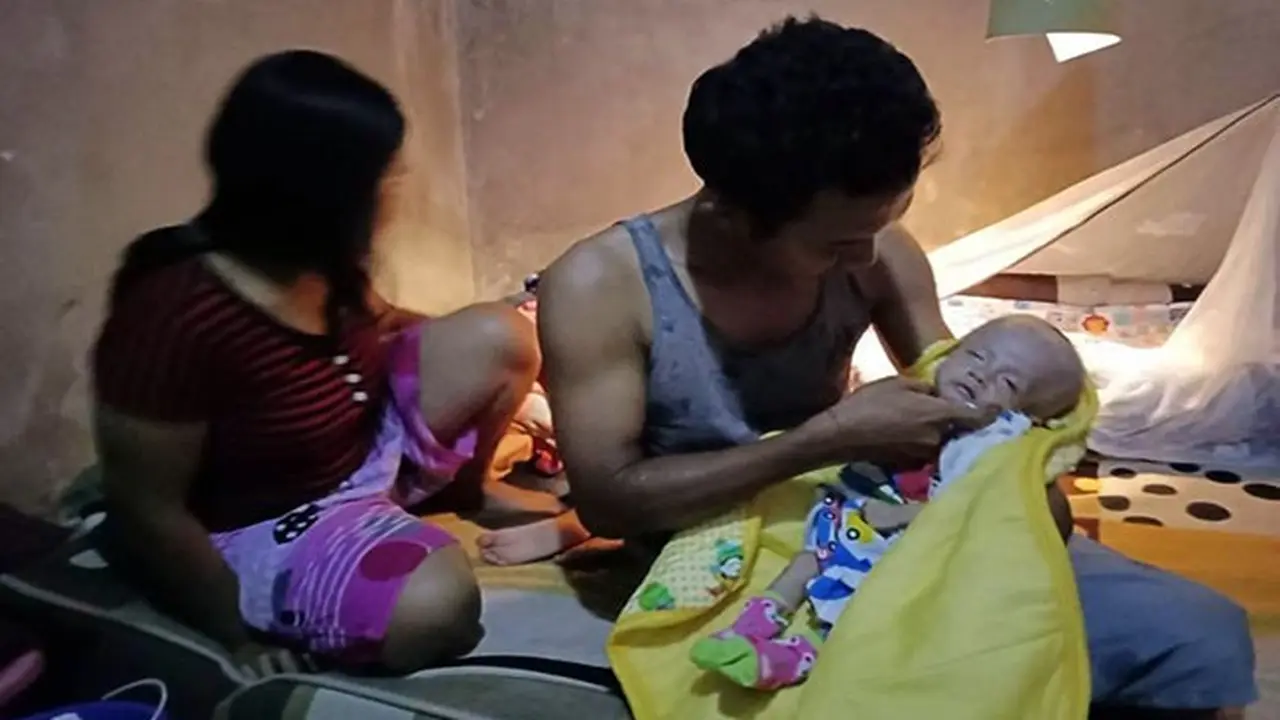 Bayi Cerebral palsy