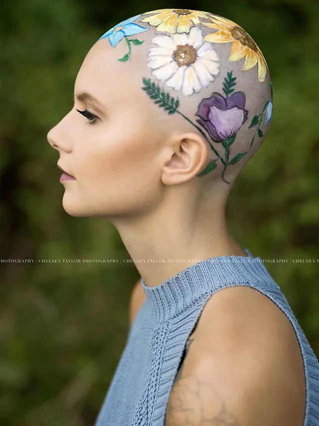 [Bintang] Anak Mengalami Kebotakan, Ibu Ini Lakukan Hal yang Luar Biasa untuk Menyemangatinya