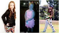 Madeline Stuart, gadis penderita down syndrome yang ingin menjadi model. (Daily Mail)