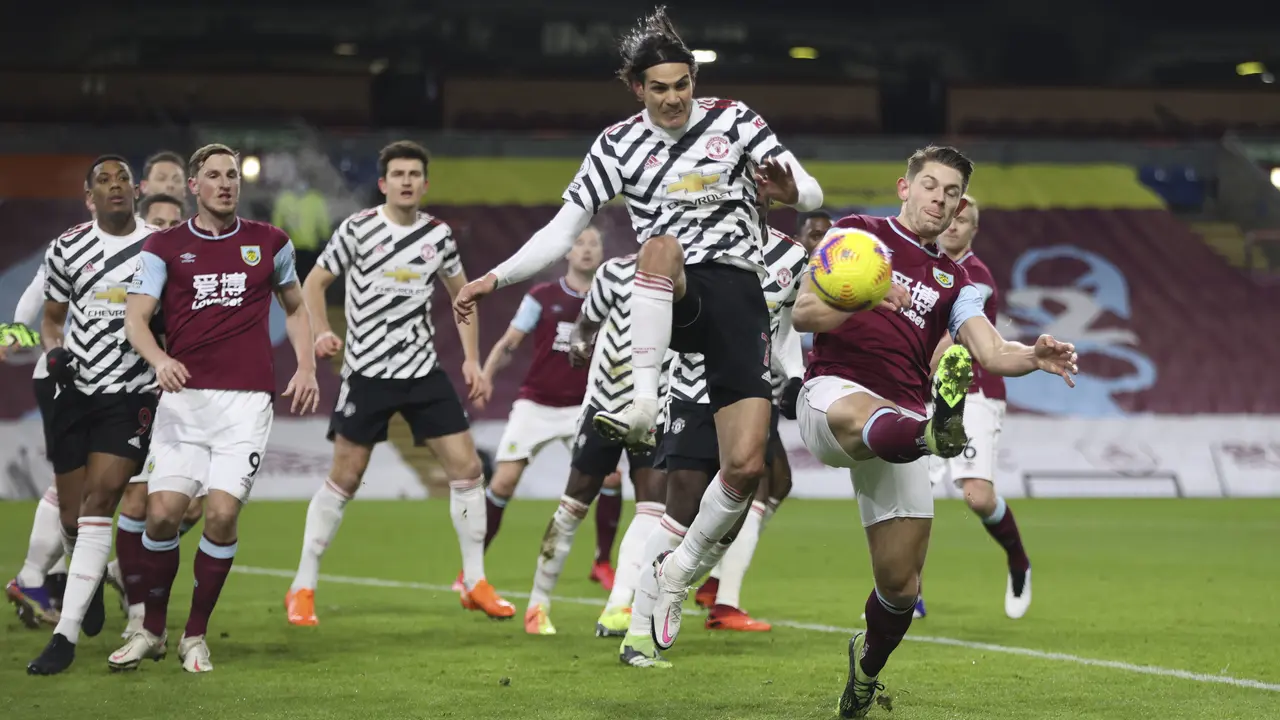 Burnley Vs Manchester United