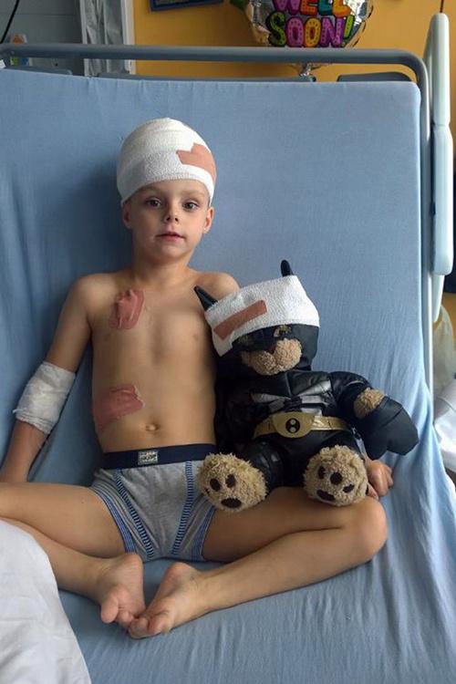 Alfie saat dirawat di rumah sakit untuk menyembuhkan kondisi langkanya | Photo: Copyright mirror.co.uk