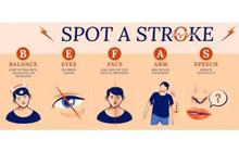 Waspadai Stroke Berulang, Cara Mengenali Tanda-tanda dan Mencegahnya