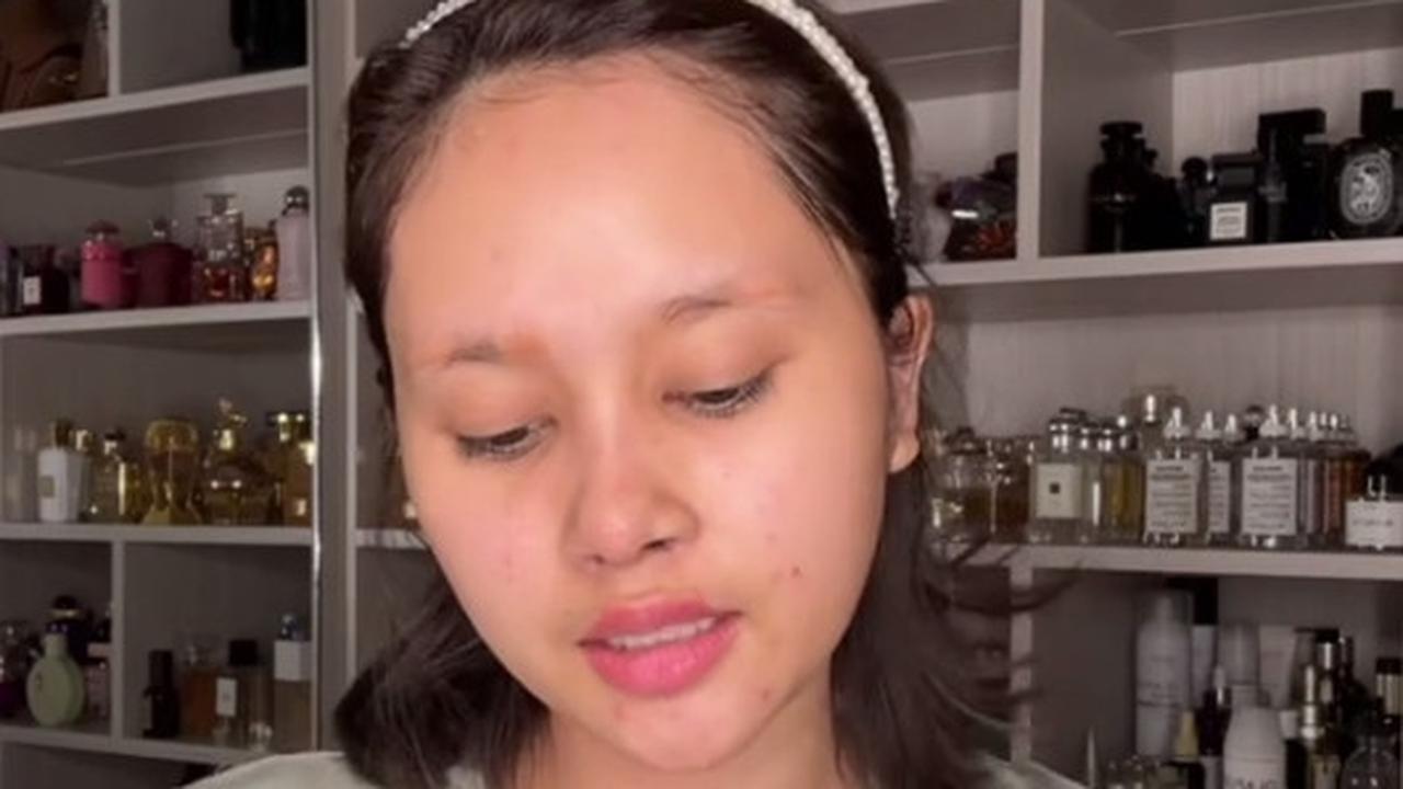 Kembali Lakukan Oplas Lagi, Ini Potret Baru Permesta Dhyaz yang Disebut Lebih Cantik Dulu