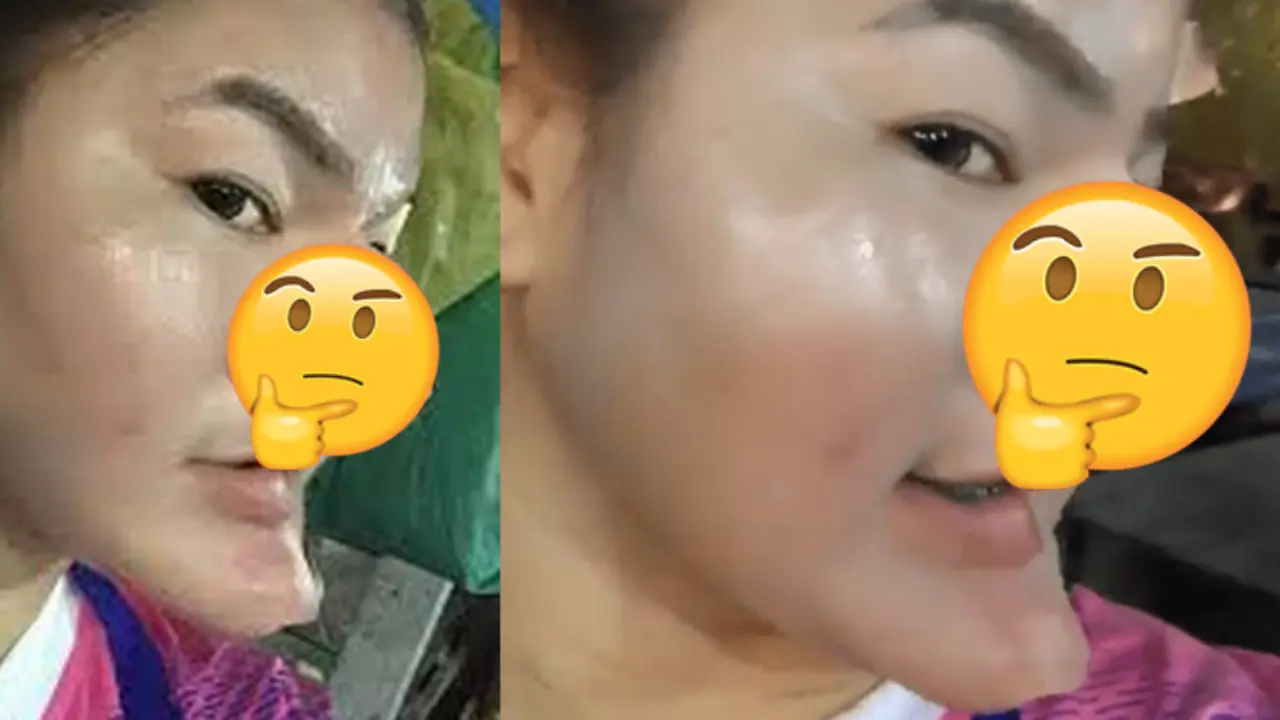 [Bintang] Mengaku Memiliki Banyak Uang dan Usai Operasi Plastik, Perempuan Ini Dibully Netizen
