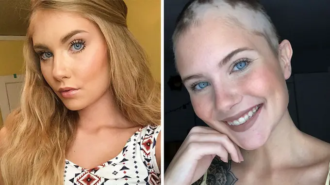 [Bintang] Anak Mengalami Kebotakan, Ibu Ini Lakukan Hal yang Luar Biasa untuk Menyemangatinya