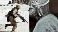 Peluru Bersarang di Leher Prajurit Perang Dunia II Ini Selama 77 Tahun, Kisahnya Viral