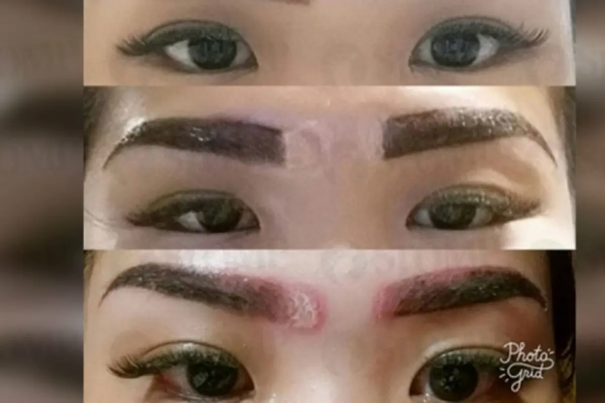 [Bintang] Gara-gara Sulam Alis, Cewek Ini Mengalami Hal yang Mengerikan