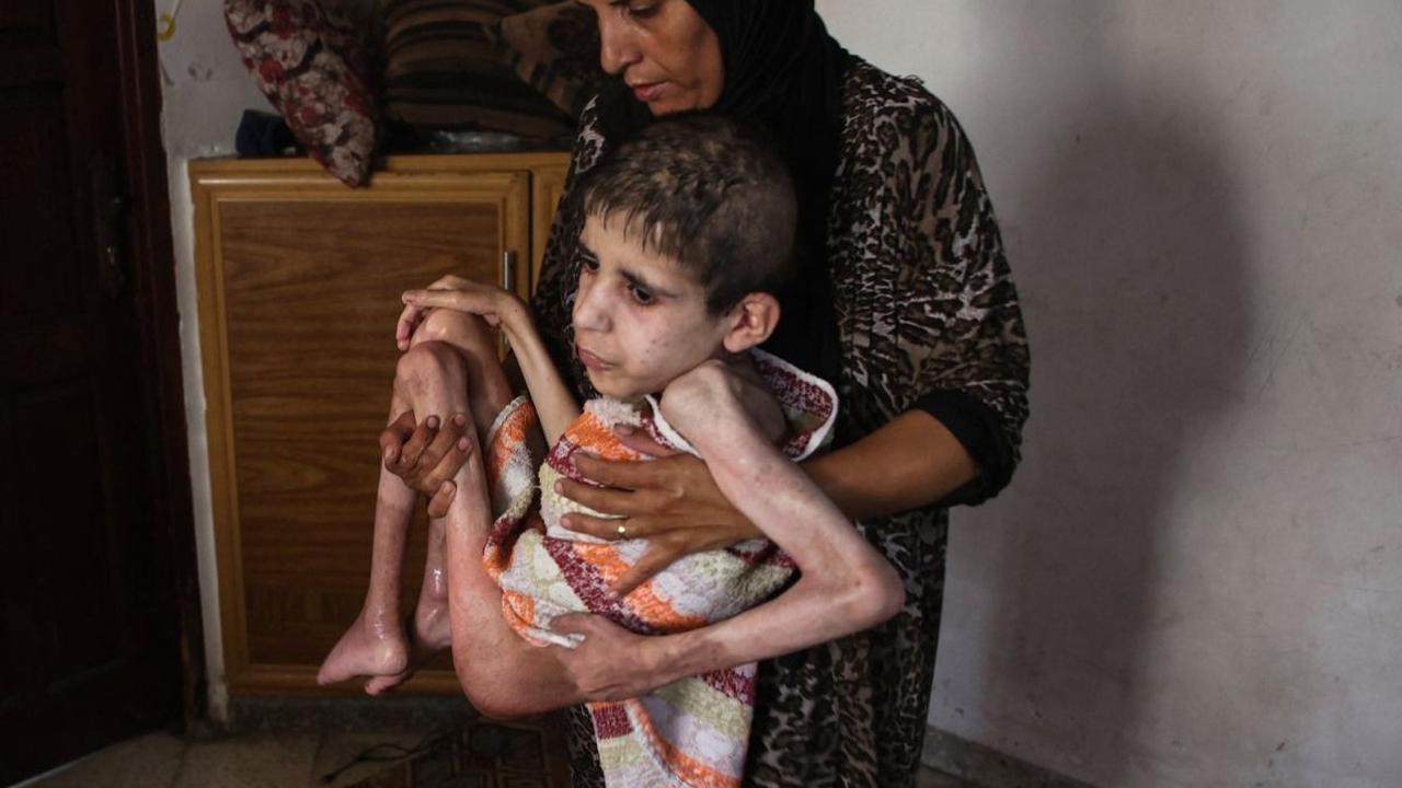 Bahaa al-Nimr, pemuda Palestina yang menderita kelumpuhan otak, digendong ibunya, Sahar, di rumahnya di lingkungan&nbsp;Sheikh Radwan, sebelah utara Kota Gaza, Jalur Gaza, pada 2 Juli 2024.&nbsp;Pengepungan Israel yang menghalangi pengiriman makanan membu