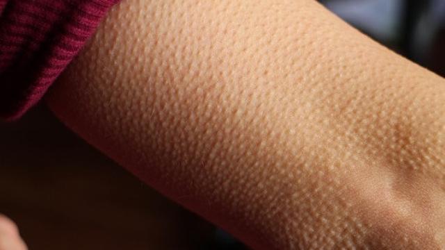 Ilustrasi Merinding (foto: Pixabay)