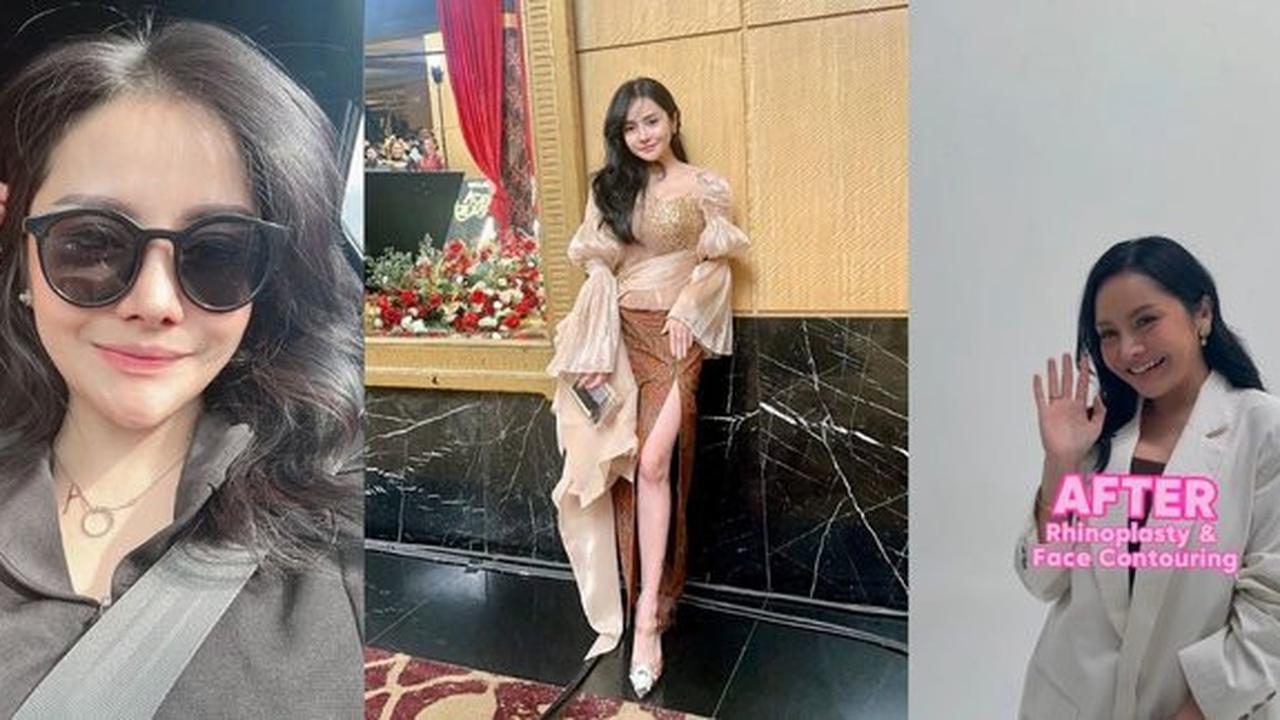 Mengaku Awalnya Hanya Ikut-ikutan Teman, Mawar AFI Ungkap Alasan Kerap Lakukan Operasi Plastik