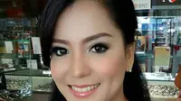Kanker Payudara Stadium 3B, Renita Sukardi Jalani Radiasi