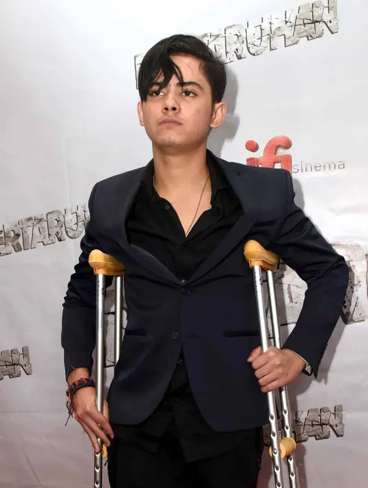 Ada yang sedikit berbeda dari Aliando Syarief saat menghadiri gala premiere film Pertaruhan. Ia hadir dengan jalan sedikit pincang dengan kruk. Ada apa dengan Aliando. (Nurwahyunan/Bintang.com)