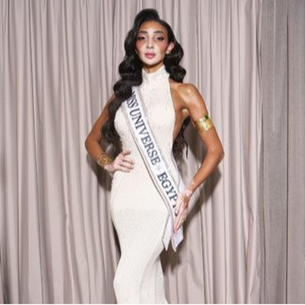 Potret Cantik Logina Salah, Miss Universe Mesir Pertama dengan Vitiligo dan Status Ibu