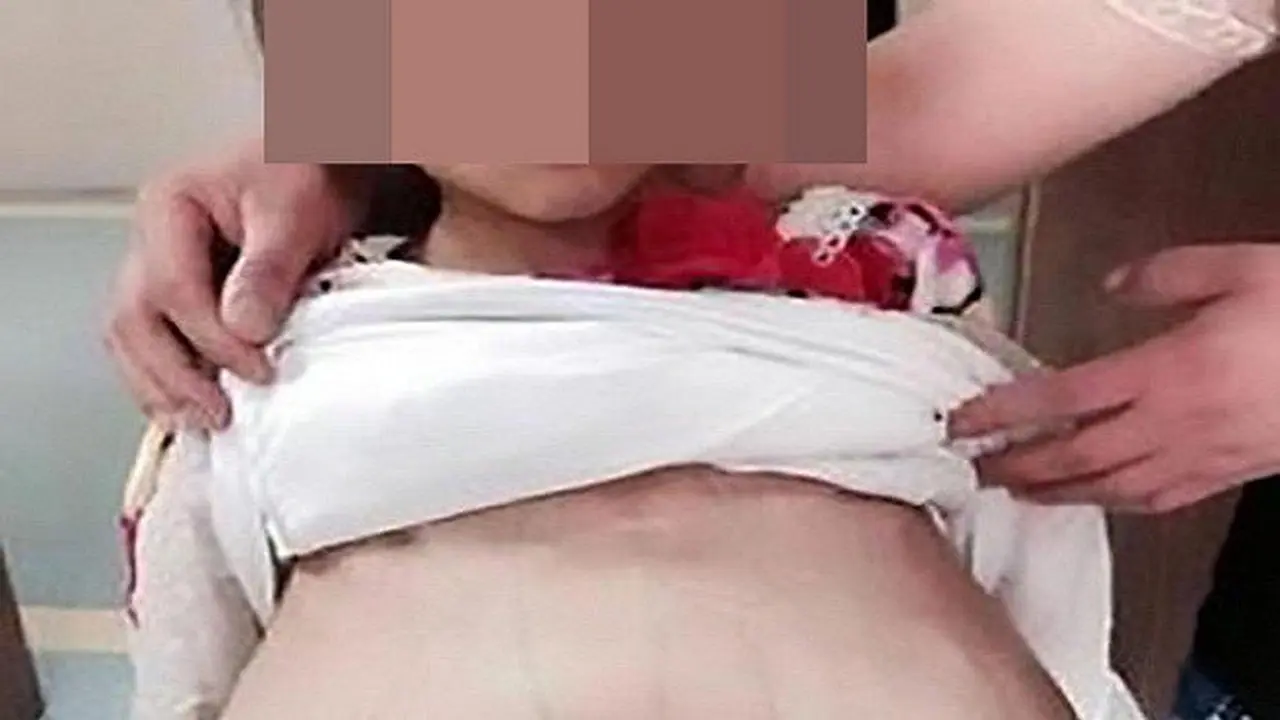 seorang anak berusia 12 tahun memeriksakan kehamilannya. Foto: Dailystar