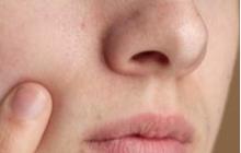 Cara Membuat Toner Alami untuk Mengecilkan Pori-pori, Mudah dan Sederhana