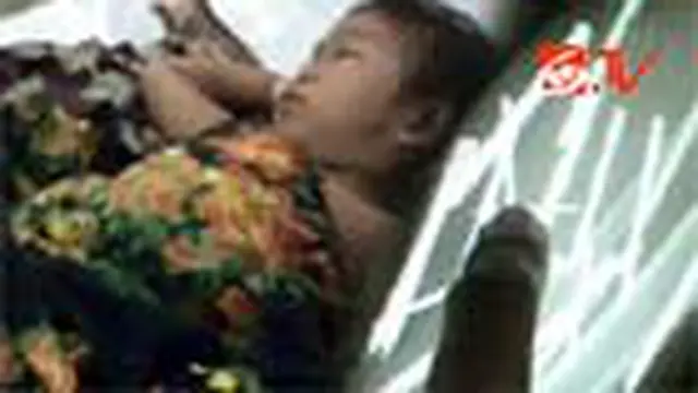 Aneh! Puluhan Paku Bersarang di Tubuh Bocah