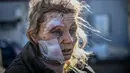 Seorang wanita yang terluka berdiri di luar rumah sakit setelah pemboman di Kota Chuguiv, Ukraina timur, 24 Februari 2022. Angkatan bersenjata Rusia mencoba menyerang Ukraina dari beberapa arah, menggunakan sistem roket dan helikopter untuk menyerang posisi Ukraina di selatan. (Aris Messinis/AFP)