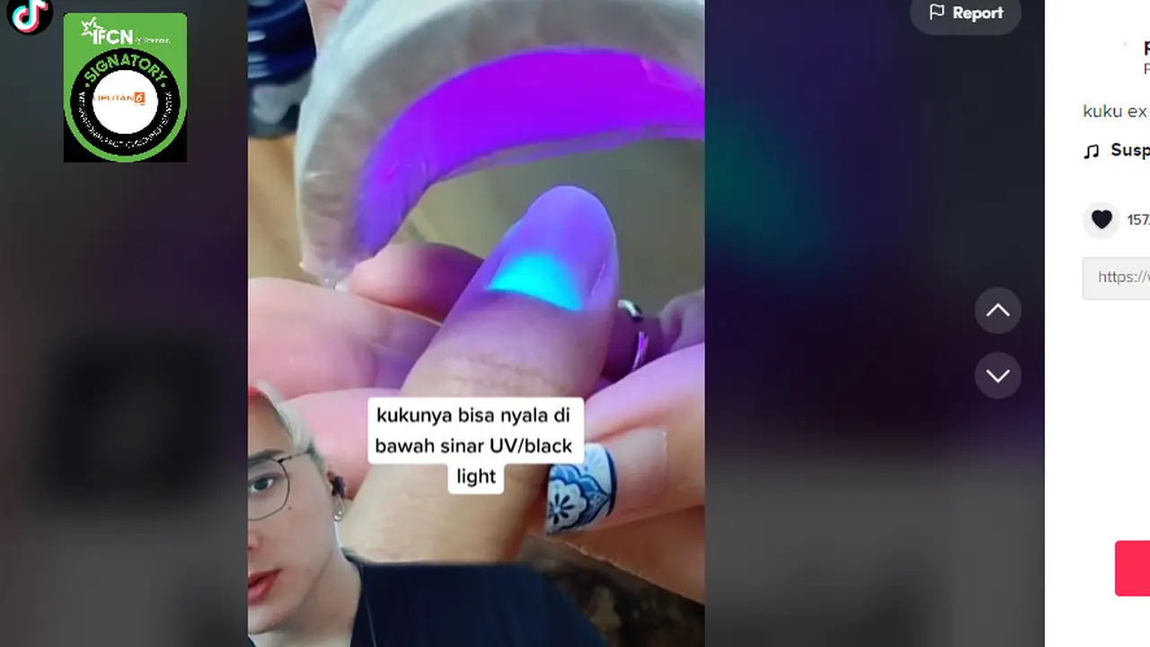 Penelusuran informasi kuku yang mengkonsumsi Favipiravir menyala ketika disinar UV