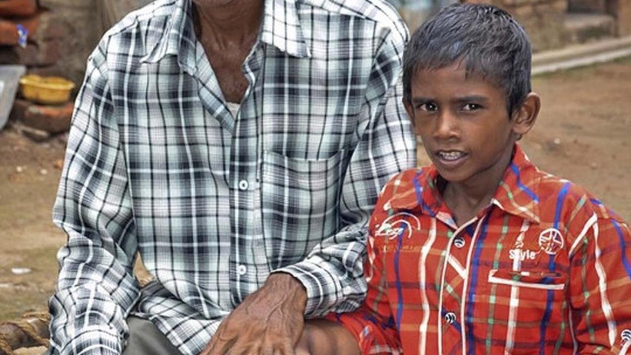 Bocah ini miliki tangan terbesar di dunia