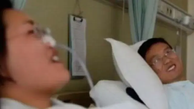 Mantan Istri Mendonorkan Livernya untuk Mantan Suami