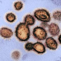 Ilustrasi gambar SARS-CoV-2, virus yang menyebabkan Corona COVID-19, diisolasi dari seorang pasien di AS. Diperoleh 27 Februari 2020 milik National Institutes of Health yang diambil dengan mikroskop elektron transmisi.(AFP/National Institutes Of Health)