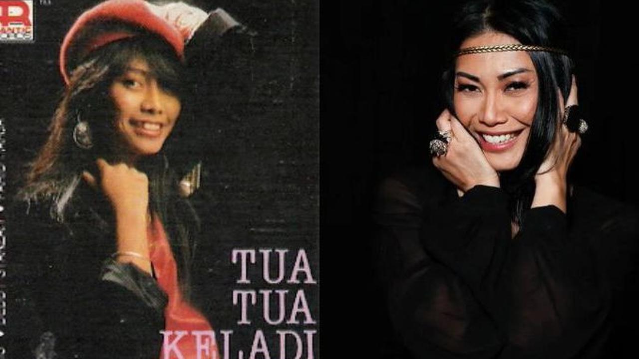 Anggun C. Sasmi, sebelum terkenal di panggung internasional, memiliki gigi gingsul yang menjadi ciri khasnya.&nbsp;