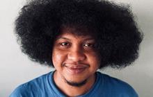 Penyebab Anemia Aplastik, Penyakit Dialami Babe Cabita Sebelum Meninggal Dunia