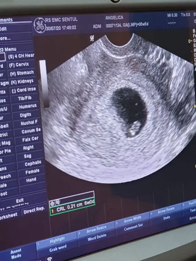 Lahirkan Anak Pertama, Ini 6 Potret Perjalanan Kehamilan Angelica Simperler