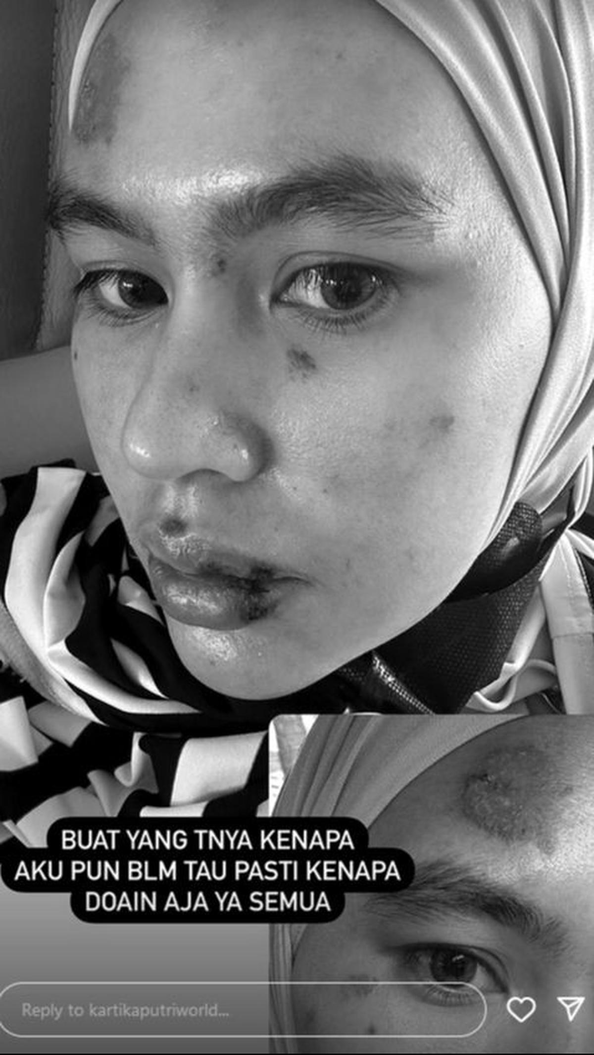 Dok. Istimewa
