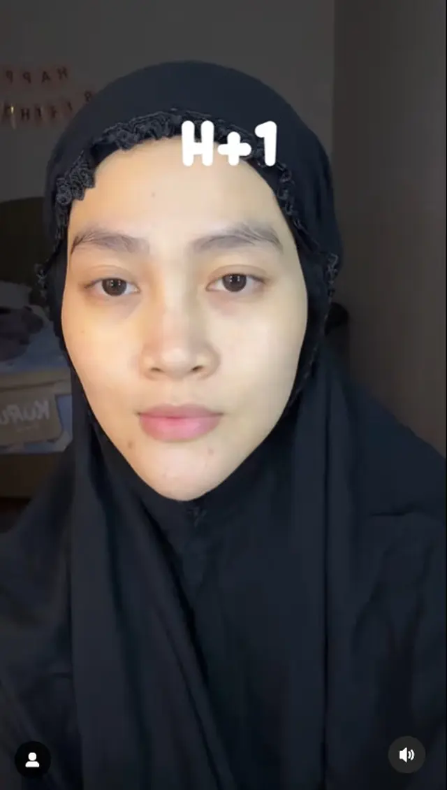 6 Potret tranformasi wajah Henny Rahman istri Alvin Faiz usai perawatan, berubah glowing dan mulus