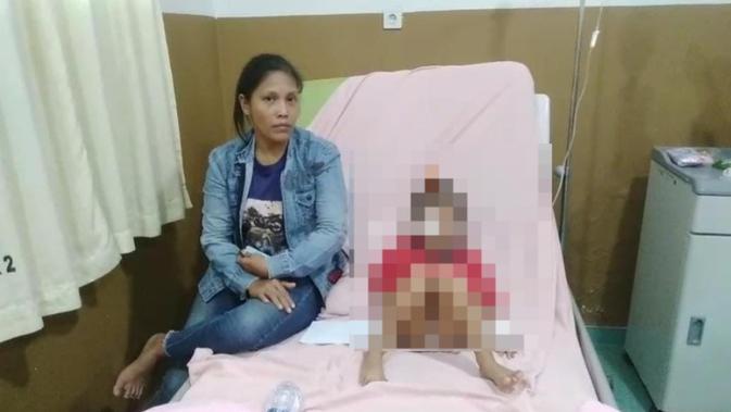 Tawuran Belawan Medan Makan Korban: Peluru Senapan Angin Hantam Pelipis Bocah Tak Berdosa