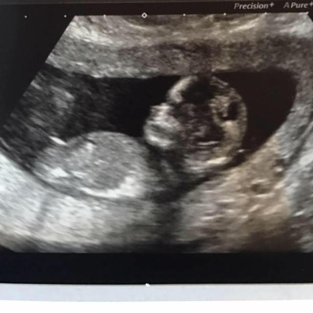 Bayi ke 20 yang diperkirakan akan lahir bulan September 2017 | Photo: Copyright metro.co.uk