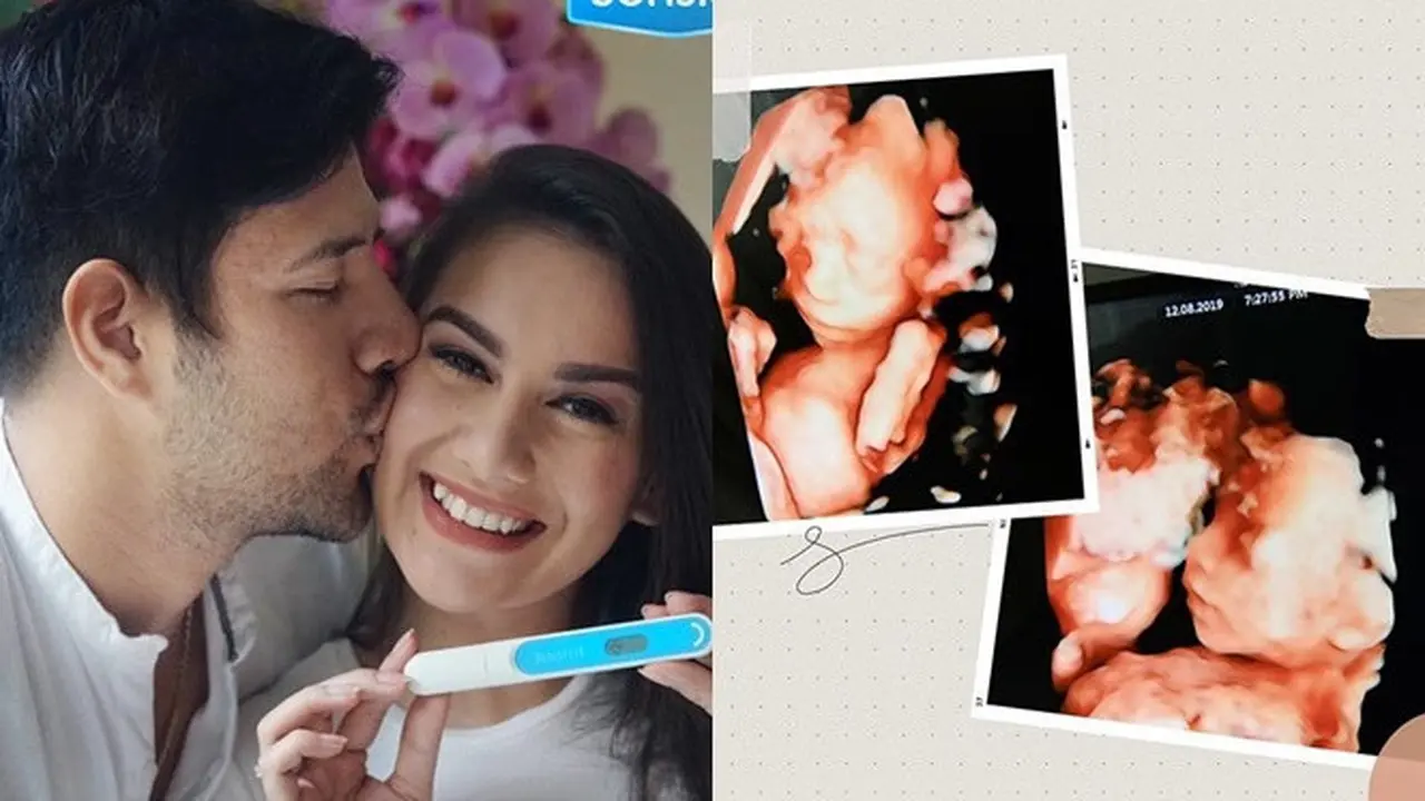 7 Potret Perjalanan Kehamilan Irish Bella Sebelum Bayi Kembarnya Meninggal
