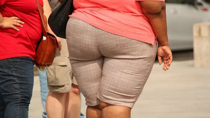 Obesitas mengancam nyawa/Foto: copyright pixabay.com