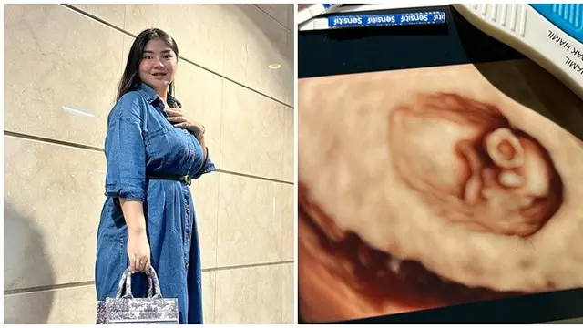 6 Potret Perjalanan Kehamilan Rosa Meldianti, Lahiran Ditemani Dewi Perssik