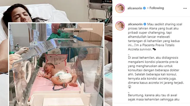 Alice Norin ceritakan pengalamannya saat hamil dan melahirkan anak kedua