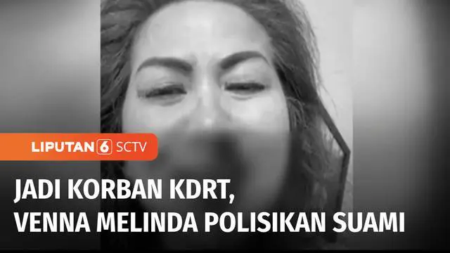 Artis Venna Melinda yang juga mantan anggota DPR RI melaporkan suaminya, Ferry Irawan ke Polda Jawa Timur atas kasus KDRT. Sebelumnya Venna Melinda diduga mengalami KDRT di sebuah hotel di Kota Kediri, Jawa Timur.