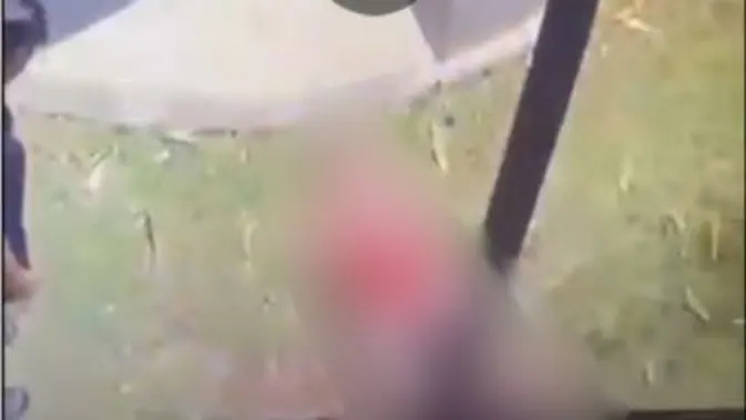 Kesaksian Keluarga Bocah yang Koma Akibat Kesetrum Usai Dibully 2 Remaja