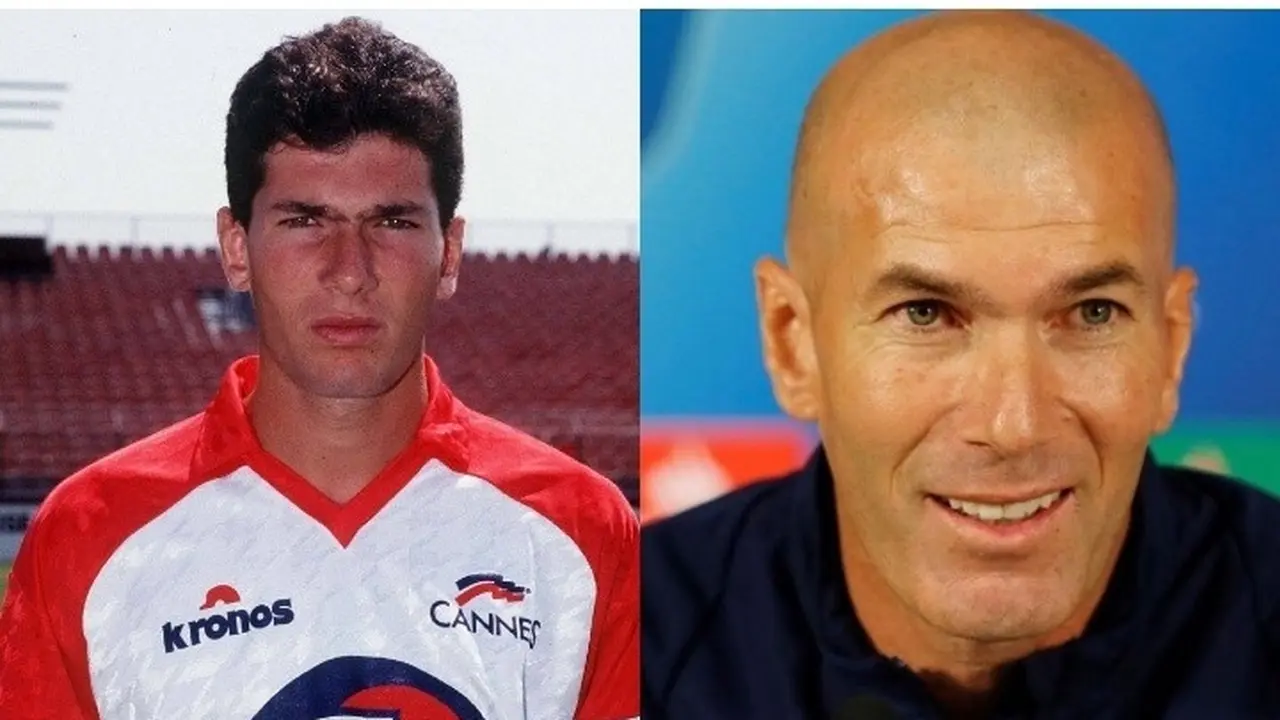 Potret Pemain Bola Gundul saat Memiliki Rambut