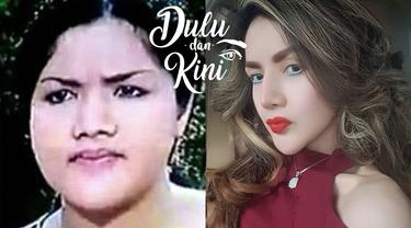 Dulu Dan Kini Transformasi Kumalasari Dari Gemuk Hingga Secantik Bidadari Beauty Fimela Com