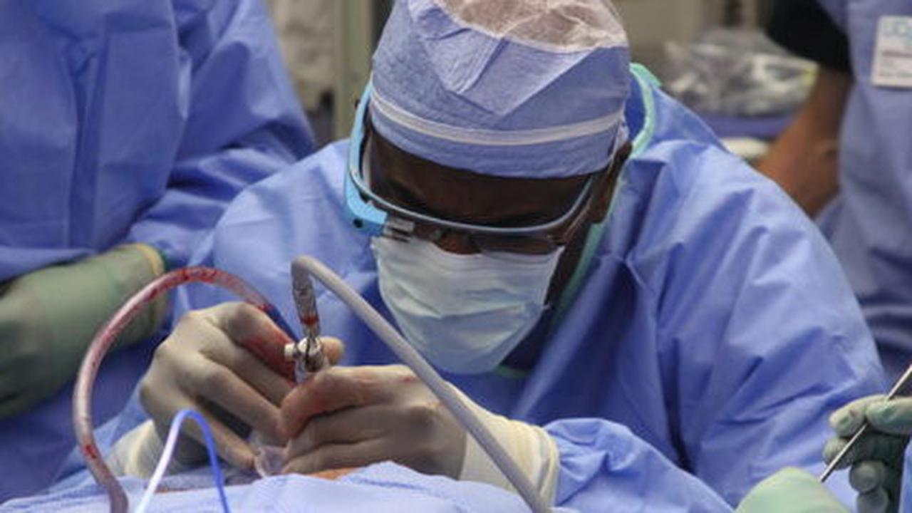 Google Glass bantu dokter membuka penyumbatan darah pasien