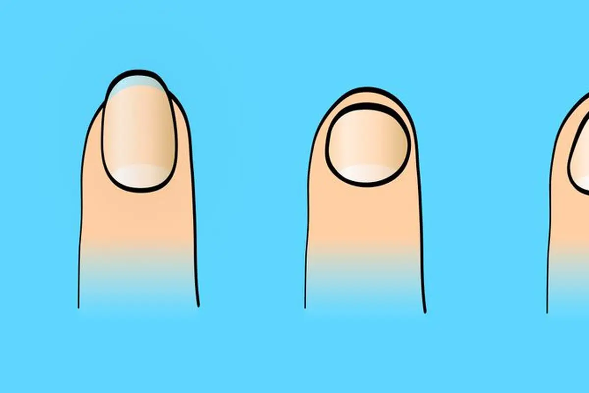 7 Cara Bentuk Kuku Beritahu Seperti Apa Kepribadian Anda Sebenarnya