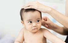 Penyebab Kepala Bayi Peyang dan Ciri-cirinya, Ketahui Cara Mencegahnya