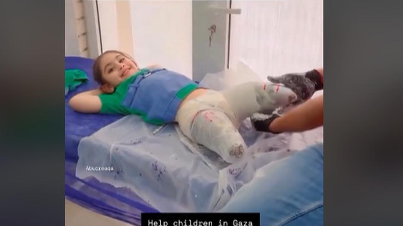 Sosok Luar Biasa Bocah Perempuan Palestina Masih Bisa Tersenyum Walau Kedua Kakinya Hilang Akibat Bom Israel