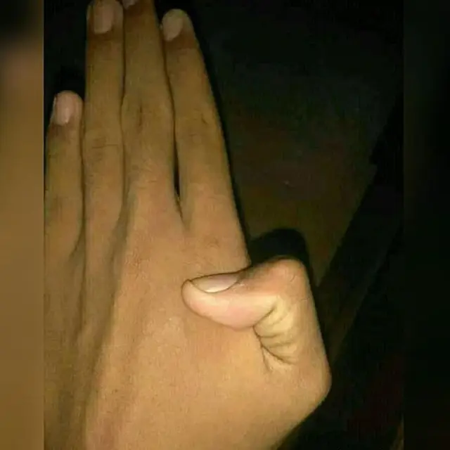 6 Aksi Nyeleneh Orang Kalau Punya Tangan Lentur Ini Bikin Heran