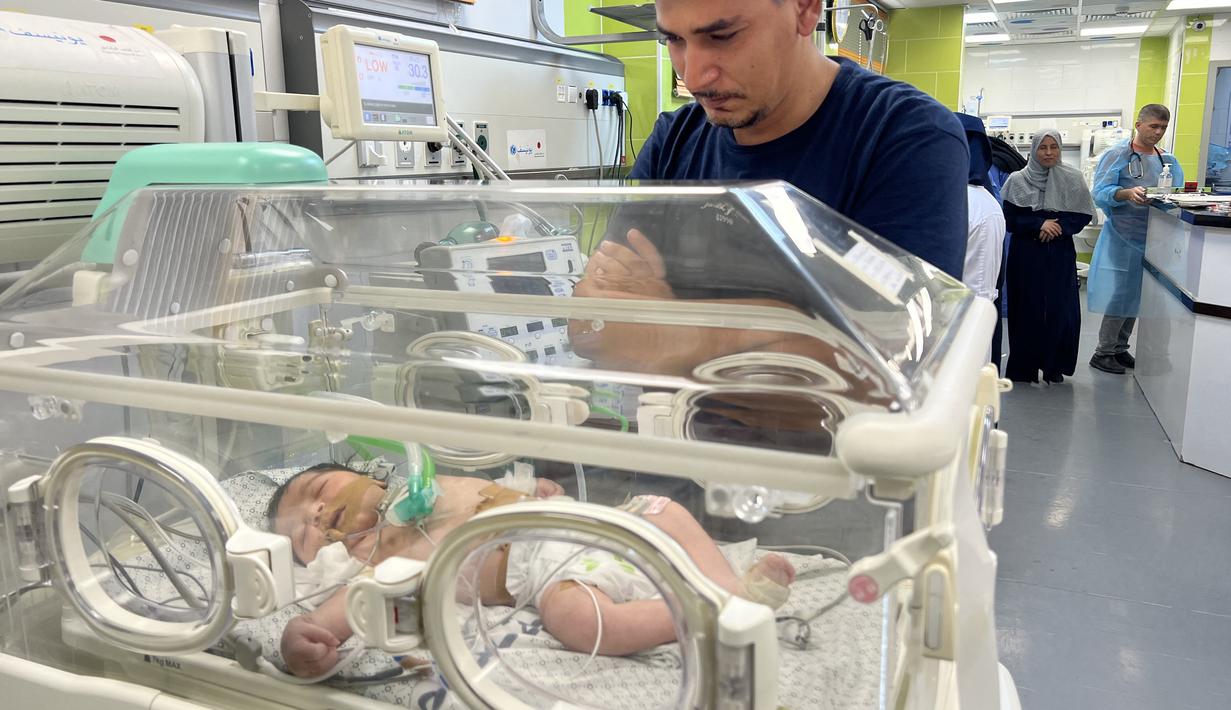 Namun diagnosis awal tidak bagus karena otaknya kekurangan oksigen antara waktu kematian ibu dan kelahirannya," kata Mohammad Salameh, kepala IGD rumah sakit, kepada AFP. (Mai YAGHI / AFP)