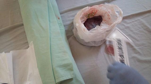 Barang bukti penganiayaan bayi oleh ibunya hingga meninggal dunia. (Foto: Liputan6.com/Polres Banyumas/Muhamad Ridlo)