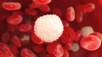Antisipasi Leukemia dengan Mengenali Penyebabnya (Royaltystockphoto.com/Shutterstock)